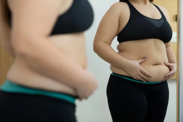 Woman with fat abdomen