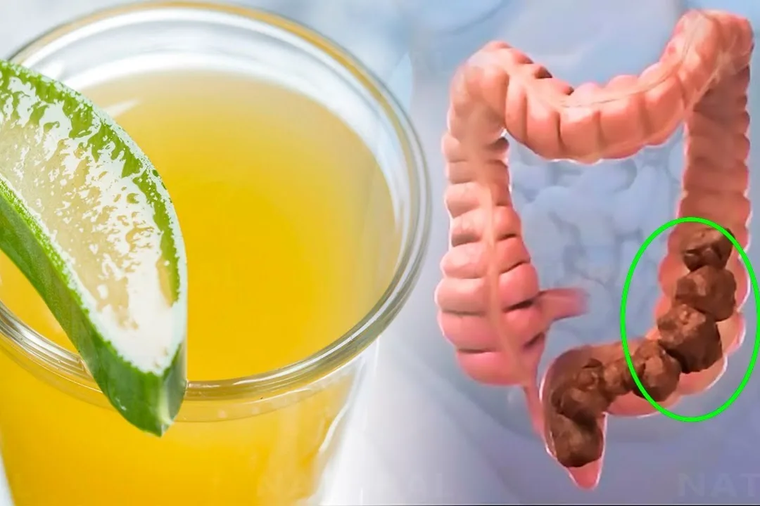 10 Natural Laxative Options: Gentle Solutions for Bowel Health a glass filled with a liquid and a green substance next to a picture of a worm and a half of a lime